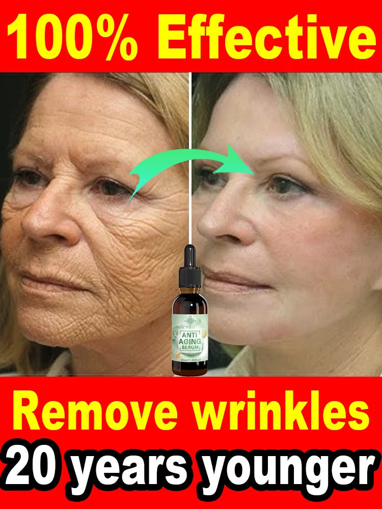 Elimine as Rugas e Fique Mais Bela Agora