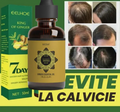 Capelli Forti e Robusti