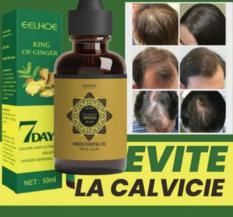 Capelli Forti e Robusti